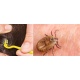 Kleszczołapki szczypce haczyki do usuwania wyciągania kleszczy 3 rozmiary dla ludzi i zwierząt